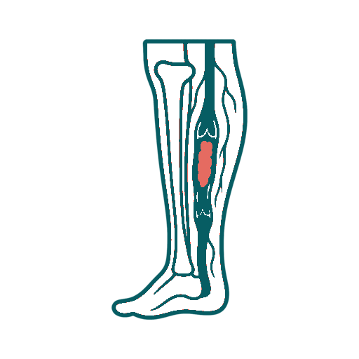 Deep Vein Thrombosis icon