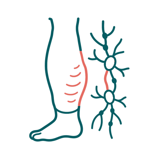 Lymphedema icon