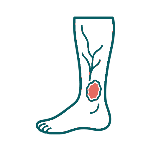 Non-Healing Leg Ulcers icon