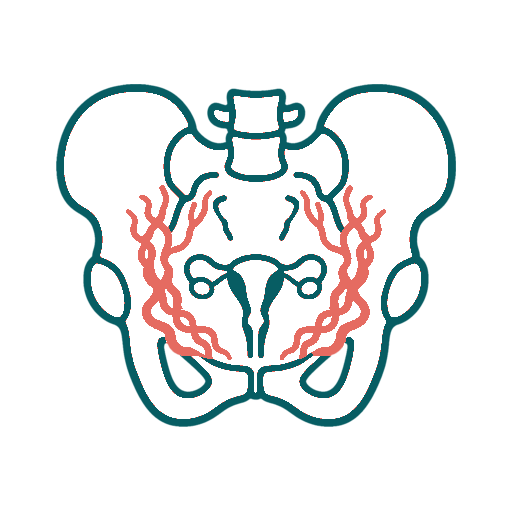 Pelvic Congestion icon