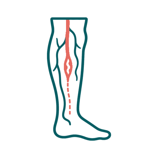 Peripheral Artery Disease icon