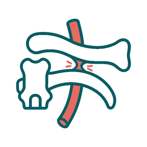 Thoracic Outlet Syndrome icon