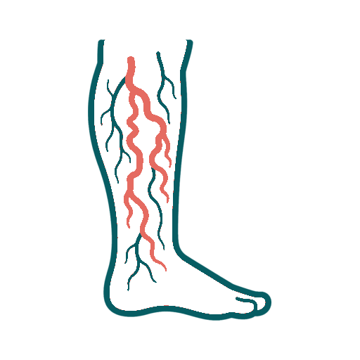Varicose Veins icon